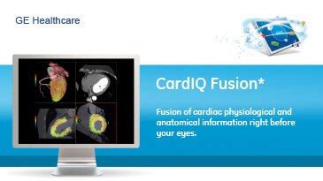 vanced-visualization-product-spec-sheets-cardiq-fusion-gehc-datasheet ...