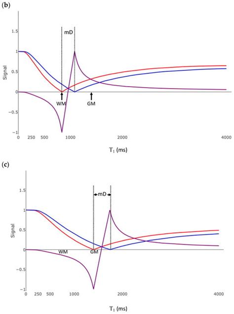 Bioengineering | Special Issue : Novel MRI Techniques and Biomedical ...