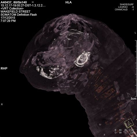 Peek Inside Cat Mummies With New X-ray Images | National Geographic