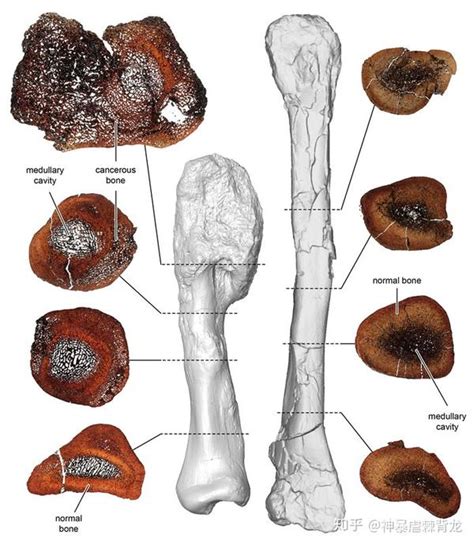 首次在有角恐龙化石中发现恶性肿瘤——骨肉瘤 - 知乎