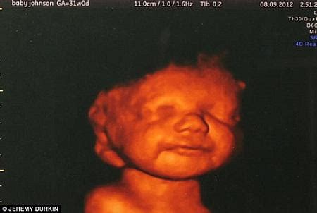 孕20周胎儿真实图片,怀孕20周胎儿高清图片(4) - 伤感说说吧