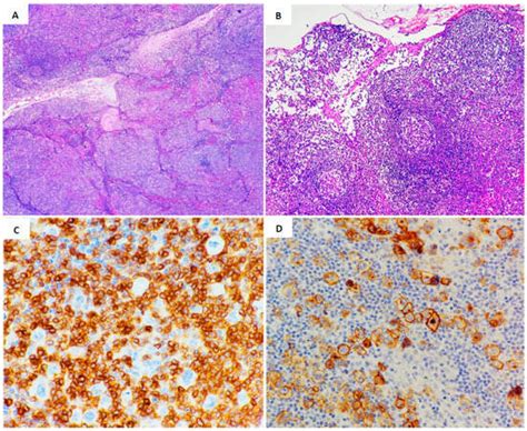 Lymphatics | An Open Access Journal from MDPI