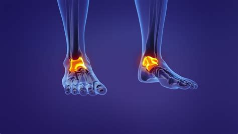 Image result for Simple Radius Fracture