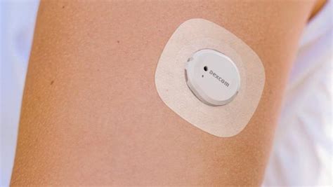 Image result for Dexcom vs Libre