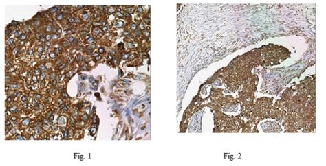 Anti-Metadherin Antibody, clone 2F11C3 | MABN699