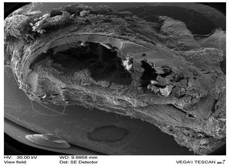 Periodontal Tissue Reaction Consecutive Implantation of Endodontic ...