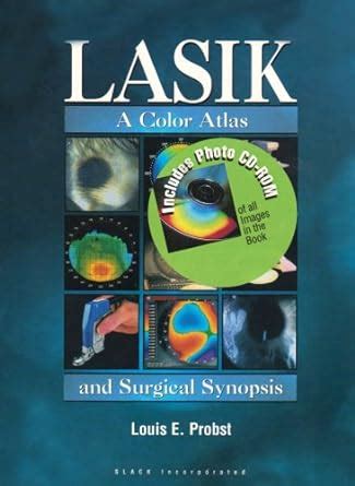 Buy LASIK: A Color Atlas and Surgical Synopsis Book Online at Low ...