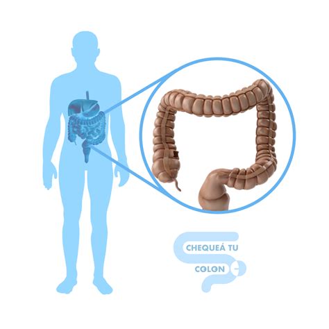 Chequeá tu Colon – Powered by CaPTyVa