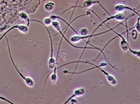 Sperms Don't Swim But Spin Like A Screw To Fertilise Eggs, Reveals Study