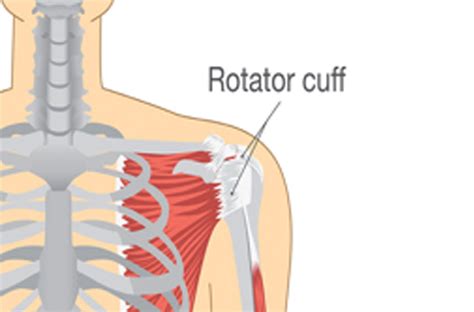 Image result for Left Rotator Cuff