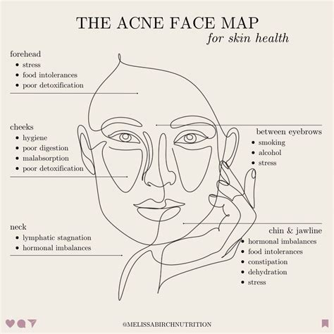 Acne face mapping what your breakouts mean acne nutritionist katie stewart wellness – Artofit