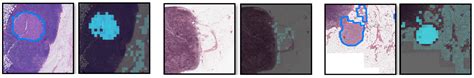 Interpretable Medical Imagery Diagnosis with Self-Attentive ...