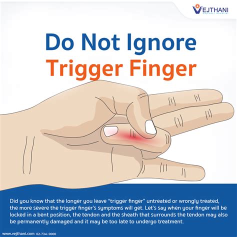 Trigger Finger Definition Etiology Symptoms Diagnosis Evaluation And