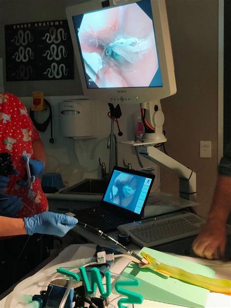 Image result for Python Snake Endoscopy