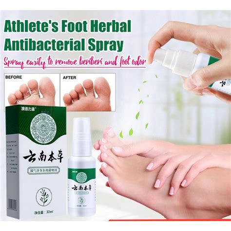🔥Athlete'S Foot Treatment Spray/Athlete'S Foot Treatment Herbal ...