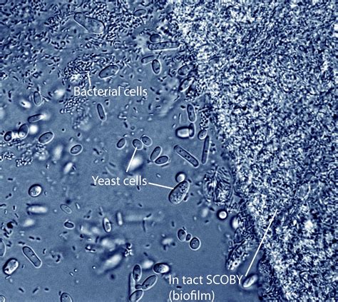 Yeast Cells Under Microscope 400x