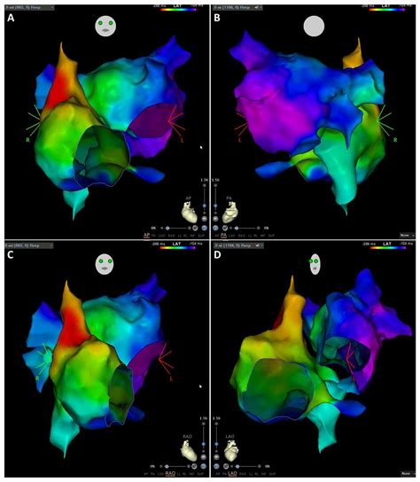 Multimodality Imaging in the Study of the Left Atrium