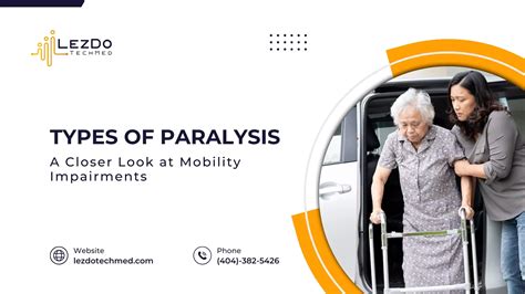 Paralysis 的图像结果