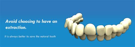 Tooth Lounge | Dental care Clinic & Implant Centre