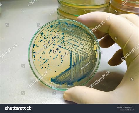 Bacteria Colony Escherichia Coli Ecoli Culture库存照片2245939181 | Shutterstock