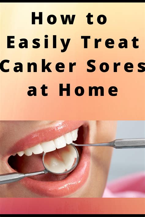 Canker sores and home remedies for treatment – Artofit