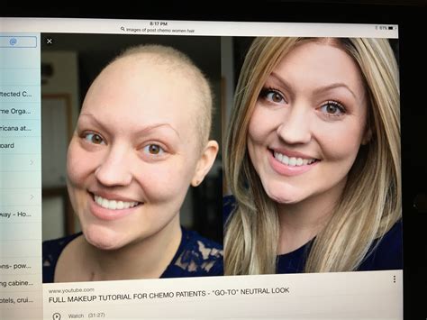 Hair growth after chemo timeline with monthly pictures – Artofit
