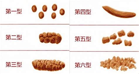 寶寶健康狀況早知道，觀察大便情況很重要，雖然噁心不過很實用！ - 每日頭條