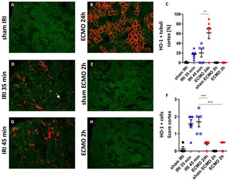 Different Acute Kidney Injury Patterns after Renal Ischemia Reperfusion ...