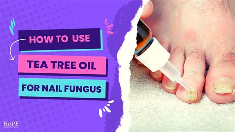 How to Use Tea tree oil for Nail Fungus? - House of Pure Essence (HoPE)