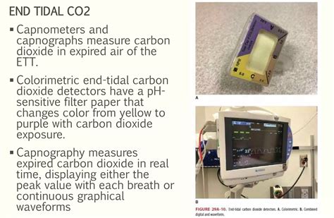 Rapid sequence intubation in ED | PPTX