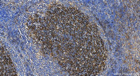 CD23 antibody (60208-1-PBS) | Proteintech