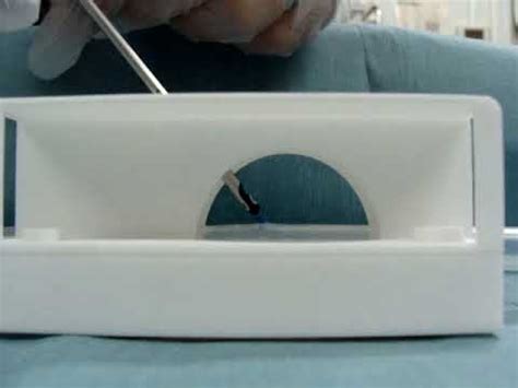 Image result for Perclose Device Tutorial