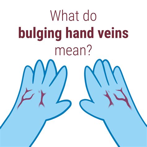 Hand Exercises To Show Veins at Victoria Jenkins blog