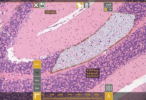 Image result for QuPath Image Analysis