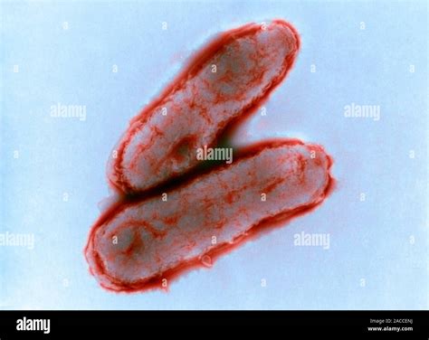 Haemophilus influenzae bacteria. Coloured transmission electron ...