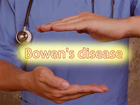 Bowens Disease: Symptoms, Causes, Diagnosis, and Treatments