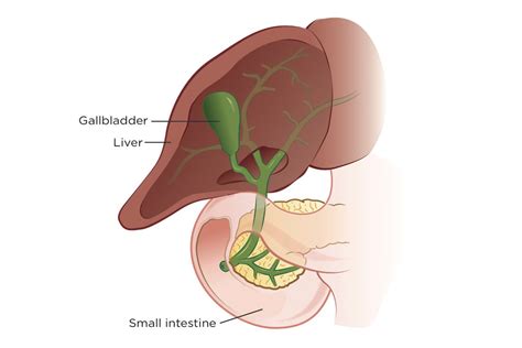 Image result for Gallbladder Cancer