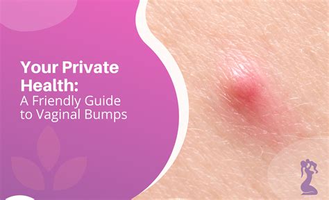 Your Private Health: A Friendly Guide to Vaginal Bumps