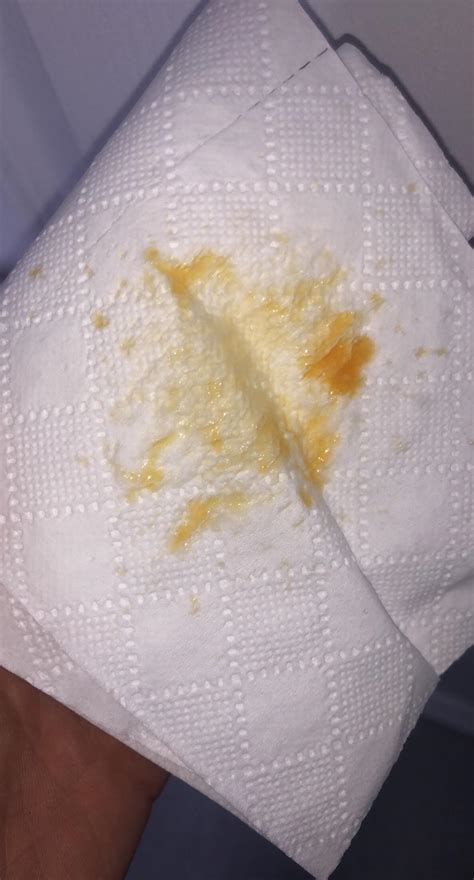 Yellowish Orange Snot From Nose