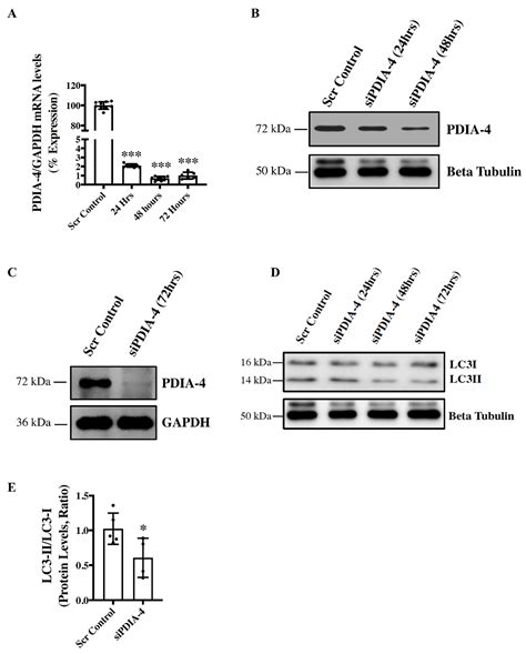 Protein Disulfide Isomerase 4 is an Essential Regulator of Endothelial ...