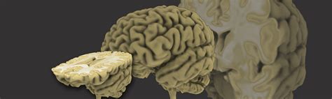 Image result for MeVisLab Connectors Triangle