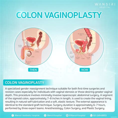 Male-to-Female (MTF) Sex Reassignment Surgery (SRS) - Wansiri Hospital