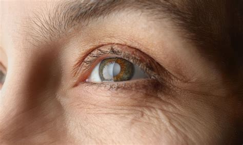 Image result for Visual Problems