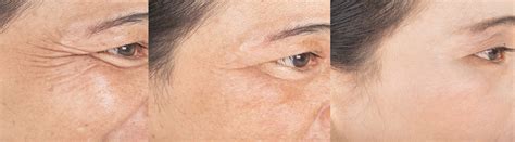 Biossential Anti-Aging Day & Night Cream- For Maintaining Youthful and