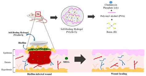 Development of Clindamycin-Releasing Polyvinyl Alcohol Hydrogel with Self-Healing Property for ...