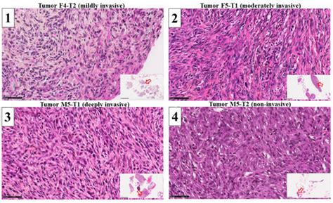 Long-Chain Acyl Coenzyme A Dehydrogenase, a Key Player in Metabolic ...