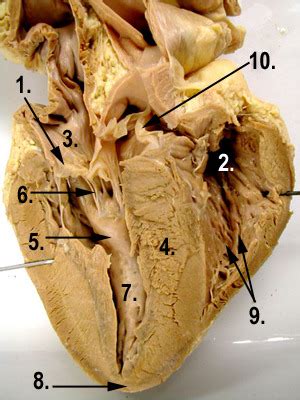 Image result for Heart Dissection Tutorial