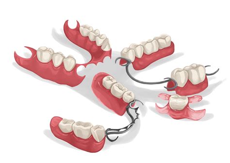 Picture by Authority Dental under CC 2.0 license