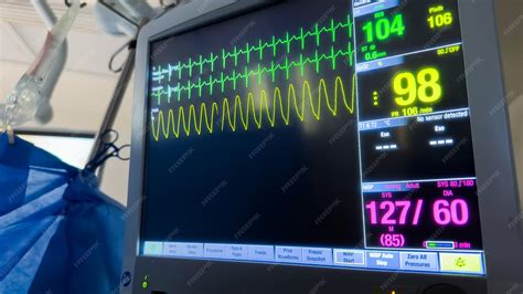 Hospital monitor machines symbolize the importance of continuous monitoring of vital signs such ...