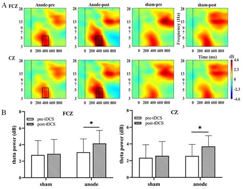 High-Definition Transcranial Direct Current Stimulation Improves ...